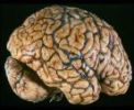 The human brain